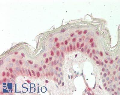 IHC-plus™ RNF20 Antibody (aa125-175)