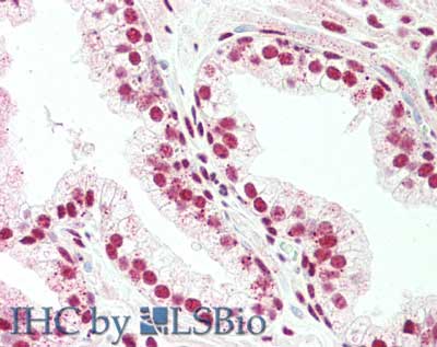 Polyclonal Rabbit anti-Human BLIMP1 / PRDM1 Antibody (C-Terminus, IHC, WB)