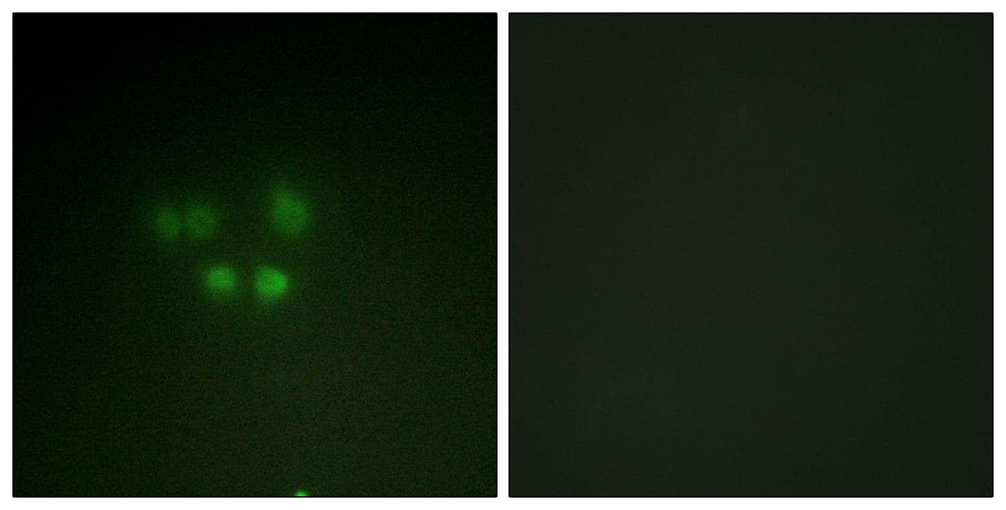 Polyclonal Rabbit anti-Human NBN / Nibrin Antibody (aa251-300, IF, WB)