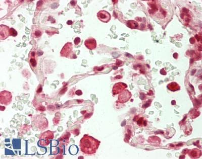 IHC-plus™ NFIB Antibody (aa325-375)