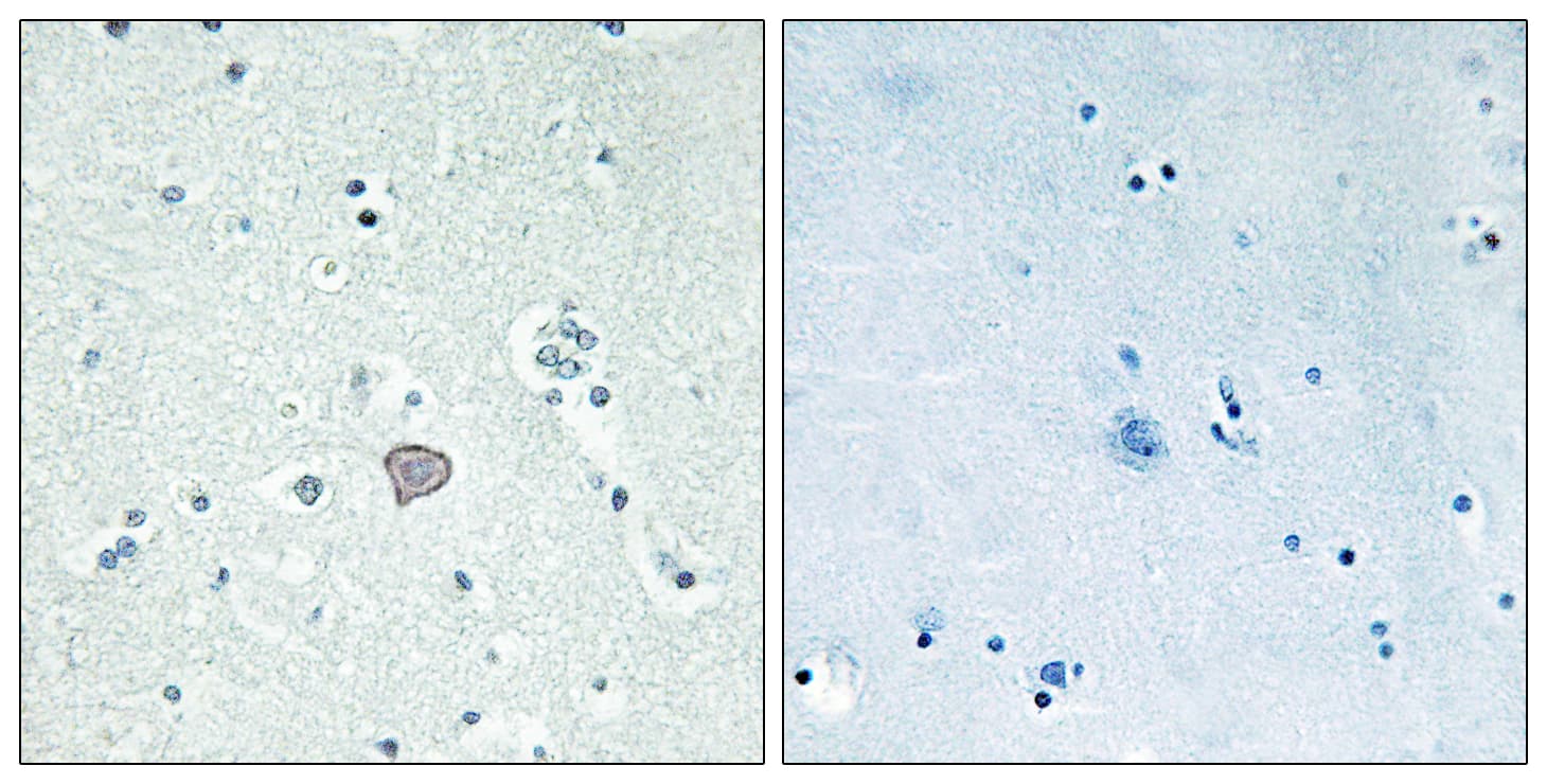 Polyclonal Rabbit anti-Human ADORA2A/Adenosine A2A Receptor Antibody (aa321-370, IHC, IF, WB)