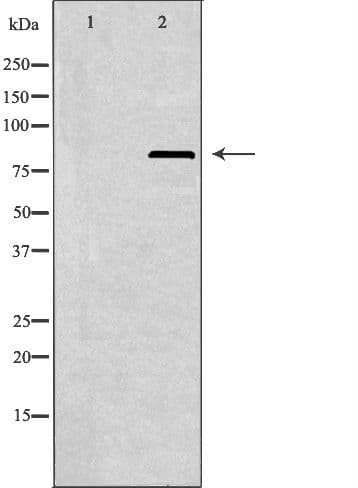 Polyclonal Rabbit anti-Human PFKL Antibody (IF, WB)
