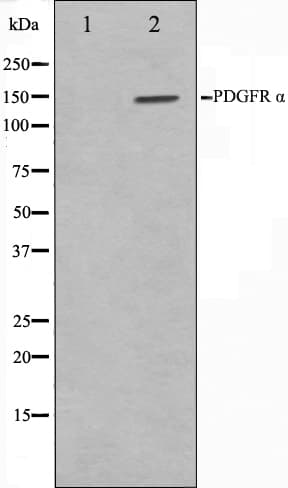 Polyclonal Rabbit anti-Human PDGFRA / PDGFR Alpha Antibody (IHC, IF, WB)