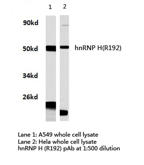 HNRNPH1 / hnRNP H Antibody (Arg192)