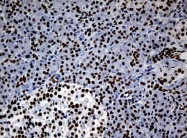 NBN / Nibrin Antibody (clone OTI3A9)