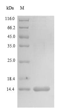 Human MKI67 / Ki67 Protein (Recombinant 6His, N-terminus)