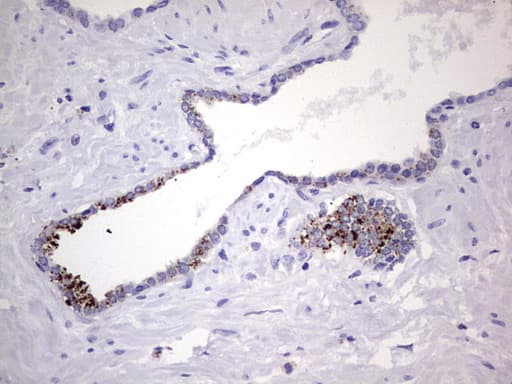 Nor-1 / NR4A3 Antibody (aa332-626, clone OTI2E1)