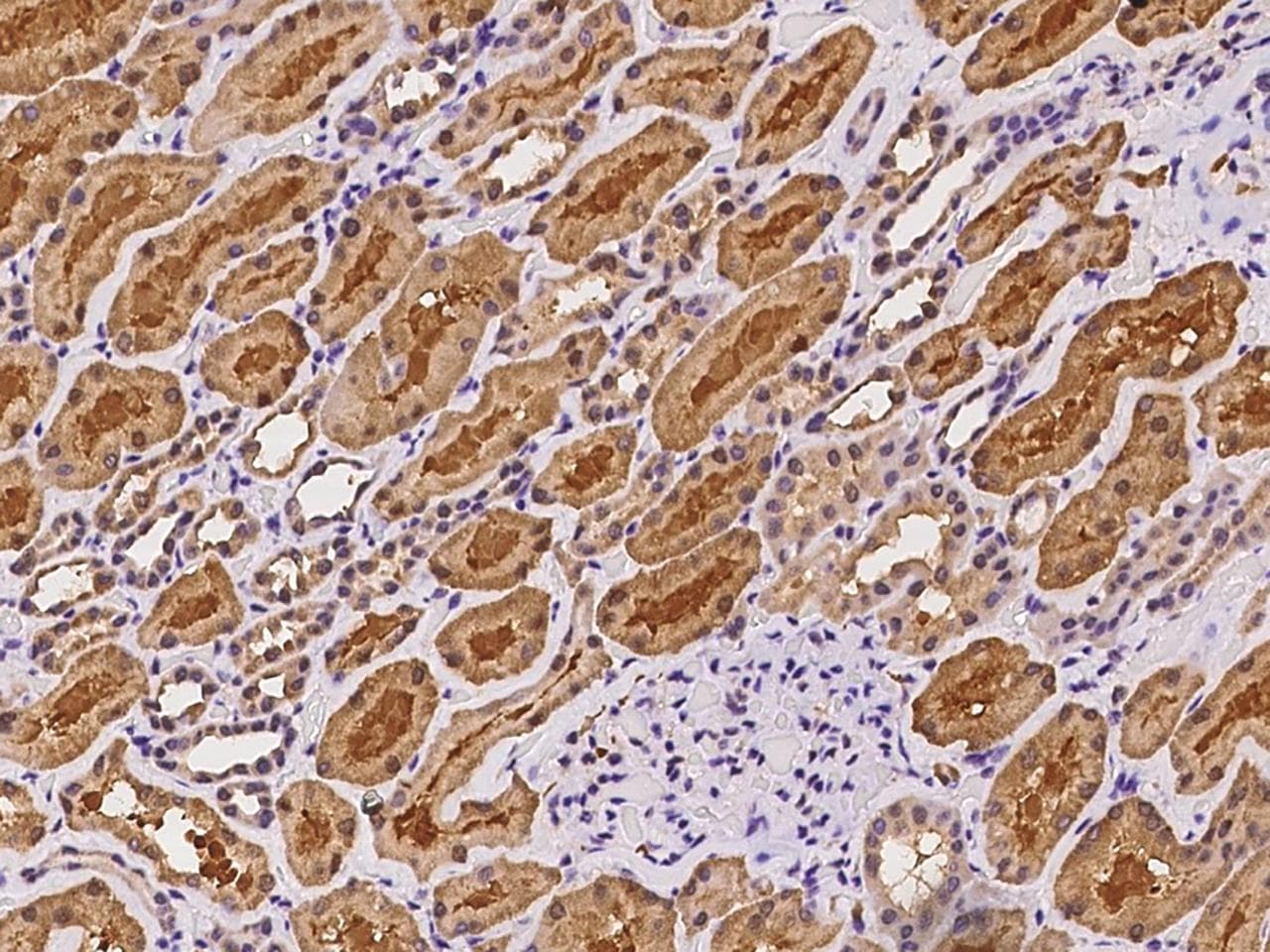 ETFDH Antibody