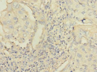 Polyclonal Rabbit anti-Human C4BPA / C4BP Alpha Antibody