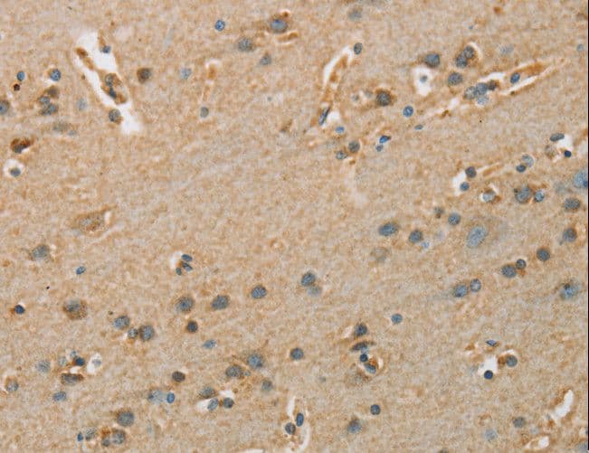 ARSA / Arylsulfatase A Antibody