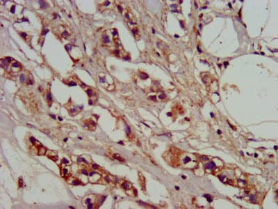 Polyclonal Rabbit anti-Human ADO Antibody (IHC)