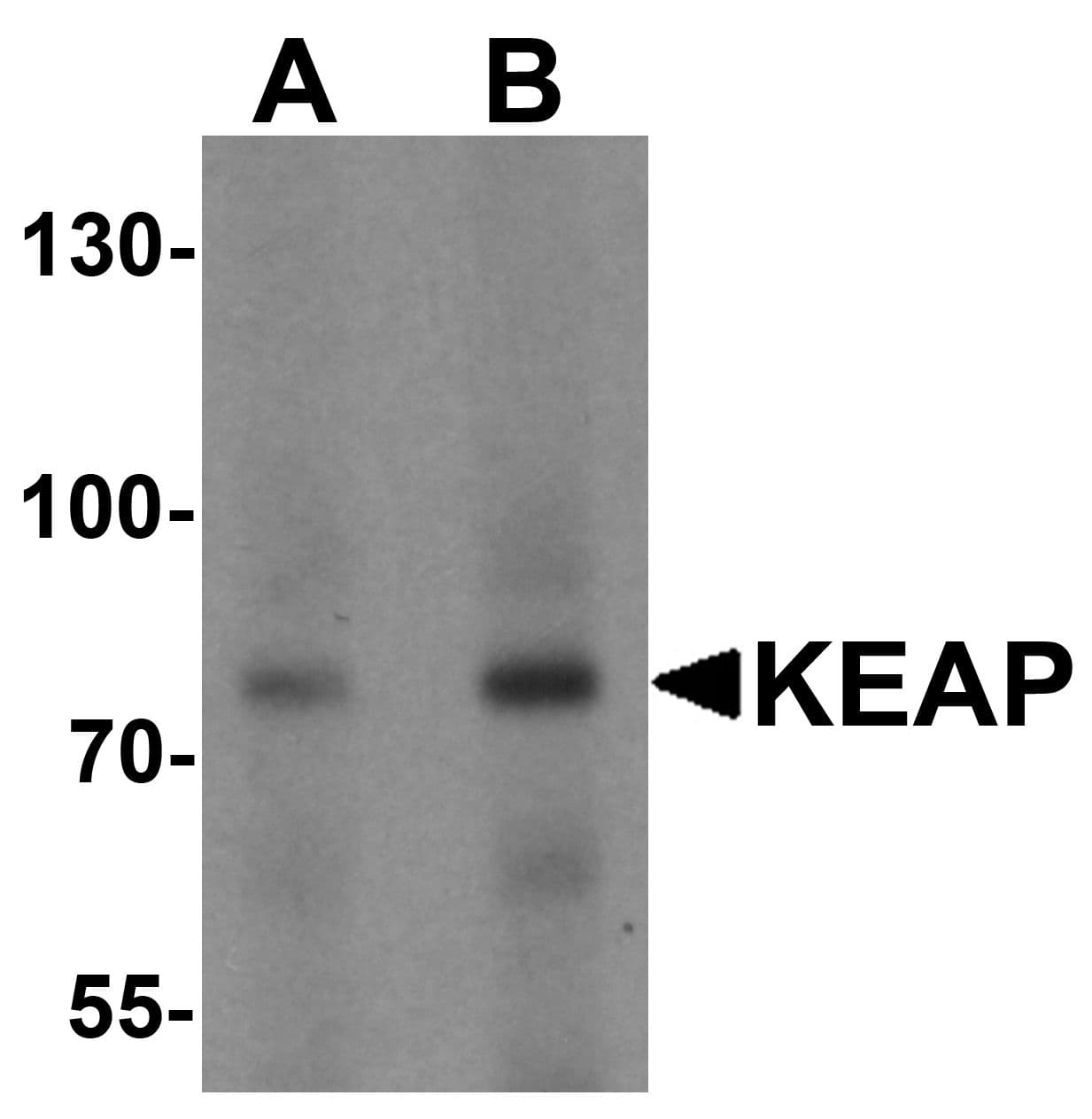 IHC-plus™ KEAP1 Antibody