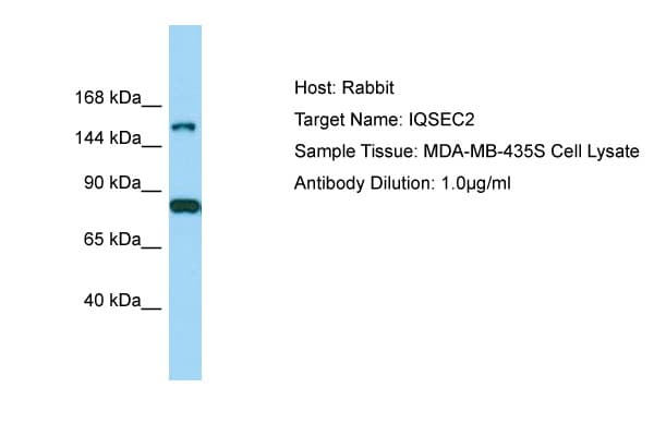 IQSEC2 Antibody (aa351-400)