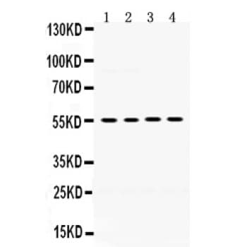 Polyclonal Rabbit anti-Mouse MMP8 Antibody (aa120-157, IHC, WB)