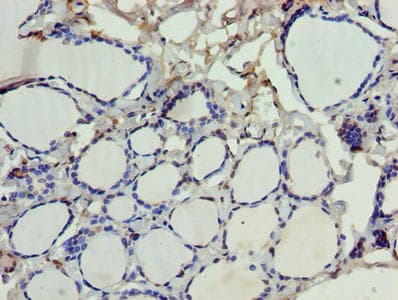 Polyclonal Rabbit anti-Human SDSL / Serine Dehydratase-Like Antibody (IHC, WB)