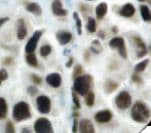 FLI1 Antibody (clone G146-222)