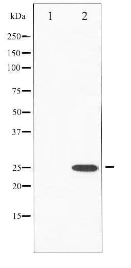 EIF4E Antibody (phospho-Ser209)