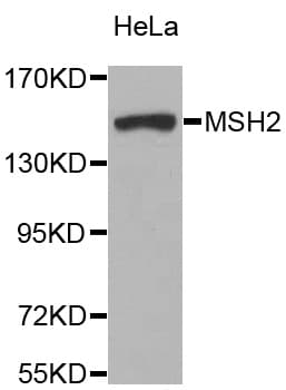 Polyclonal Rabbit anti-Human MSH2 Antibody (IHC, IF, WB)