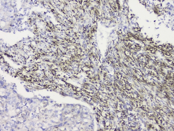 Polyclonal Rabbit anti-Human RRBP1 / hES Antibody (IHC, WB)