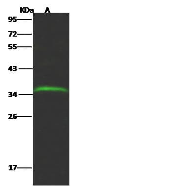 GLT8D2 Antibody (Preservative Free)