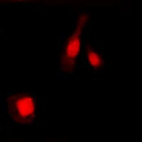 NFKB1 / NF-Kappa-B Antibody (phospho-Ser337)