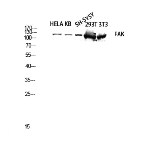 FAK / Focal Adhesion Kinase Antibody (780-860 aa)