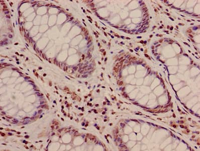 Polyclonal Rabbit anti-Human HIST1H3A Antibody (IHC, IF, WB)