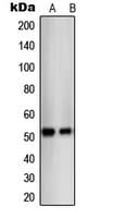 NR1A2 / THRB Antibody (N-Terminus)