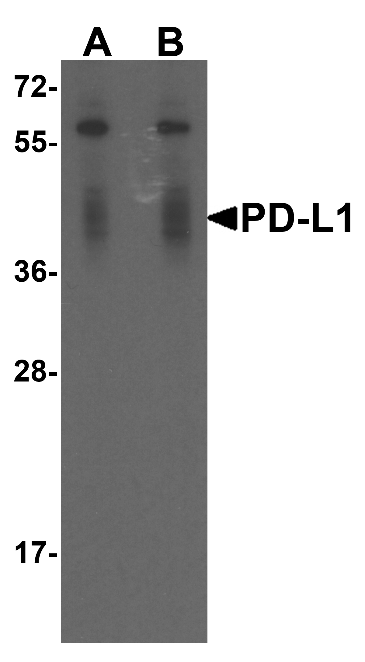 CD274 / B7-H1 / PD-L1 Antibody (clone 1F11)
