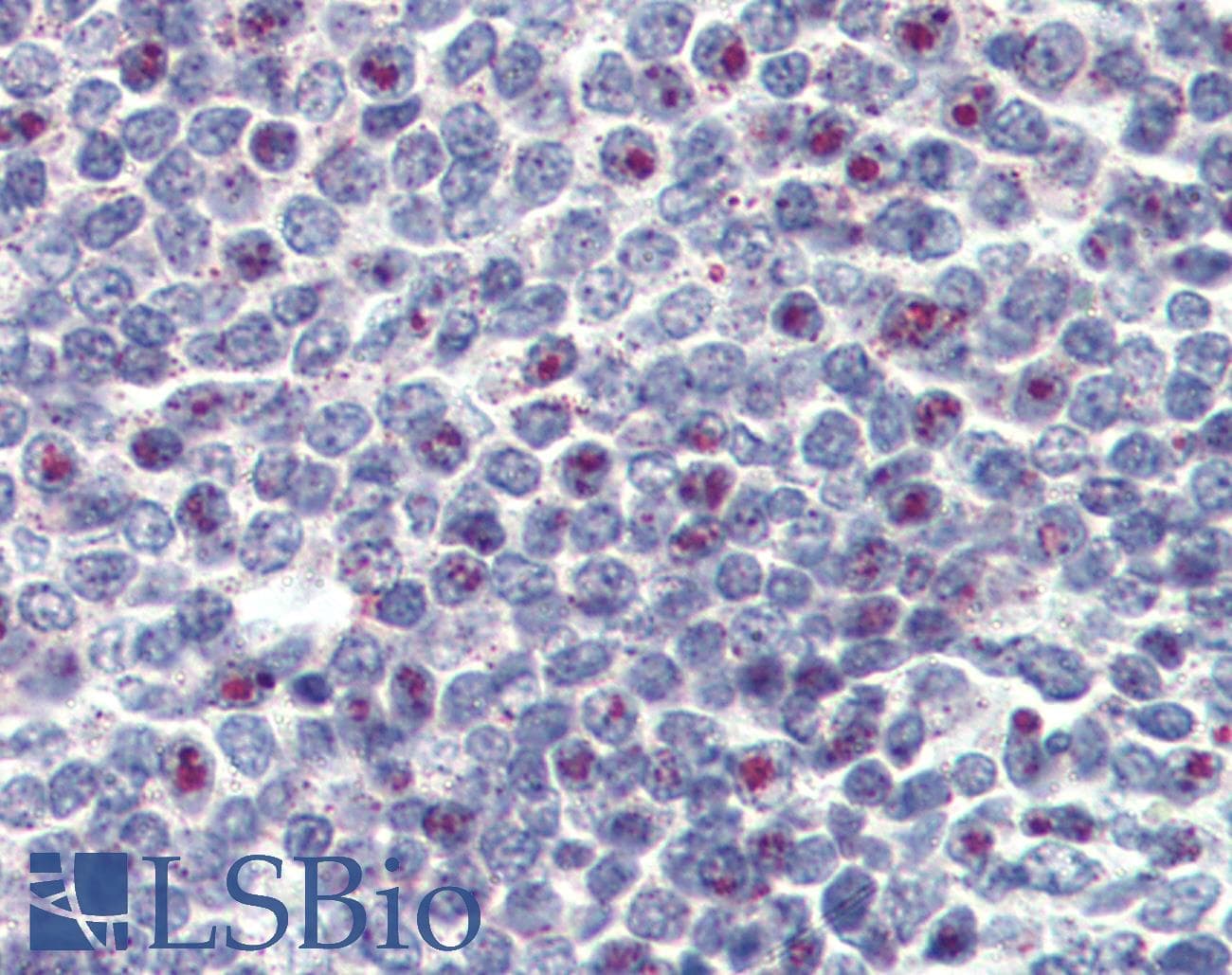 IHC-plus™ KMT2A / MLL Antibody (aa3751-3968, clone 10F8D7)