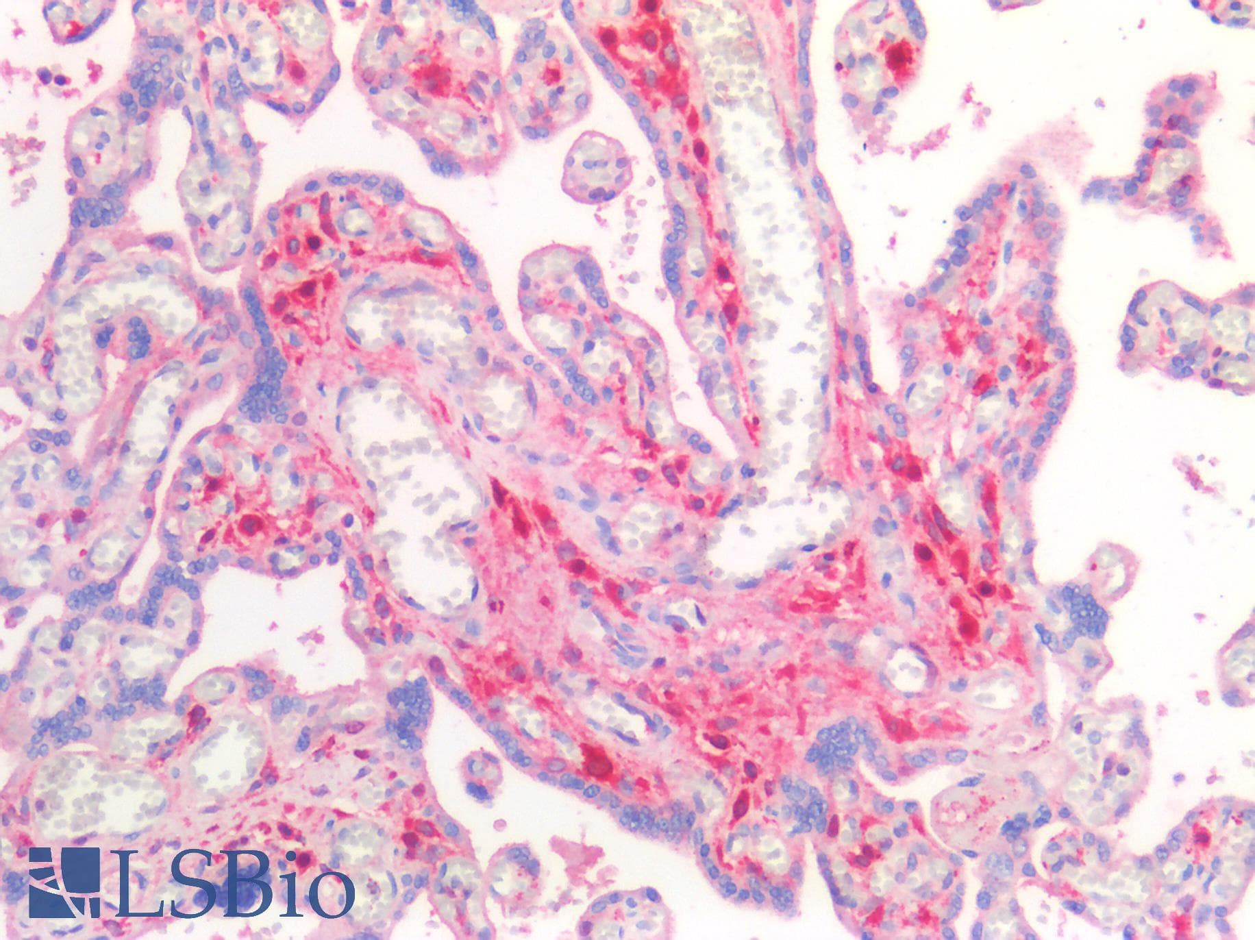IHC-plus™ MMP2 Antibody