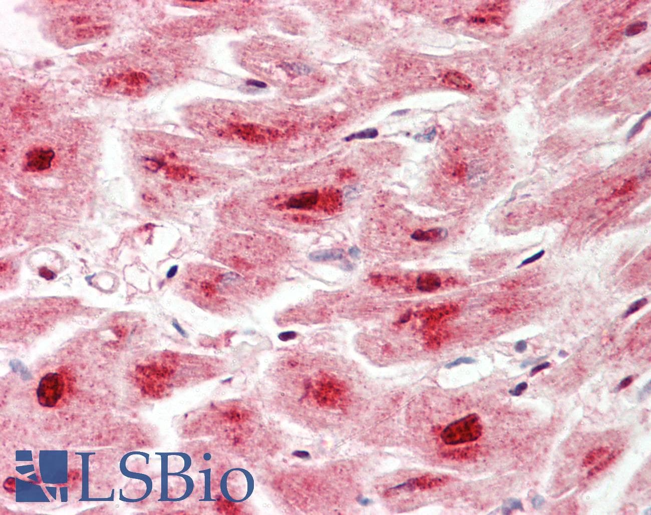 IHC-plus™ Polyclonal Rabbit anti-Human LONP1 / LON Antibody (aa389-418, IHC, WB)