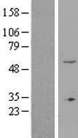 ZNF77 Protein (Over-Expression Lysate Myc-DDK (Flag))