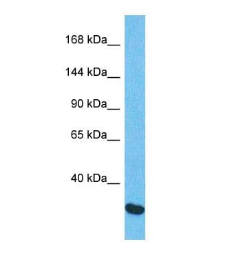 CHPF / CHSY2 Antibody (aa33-82)