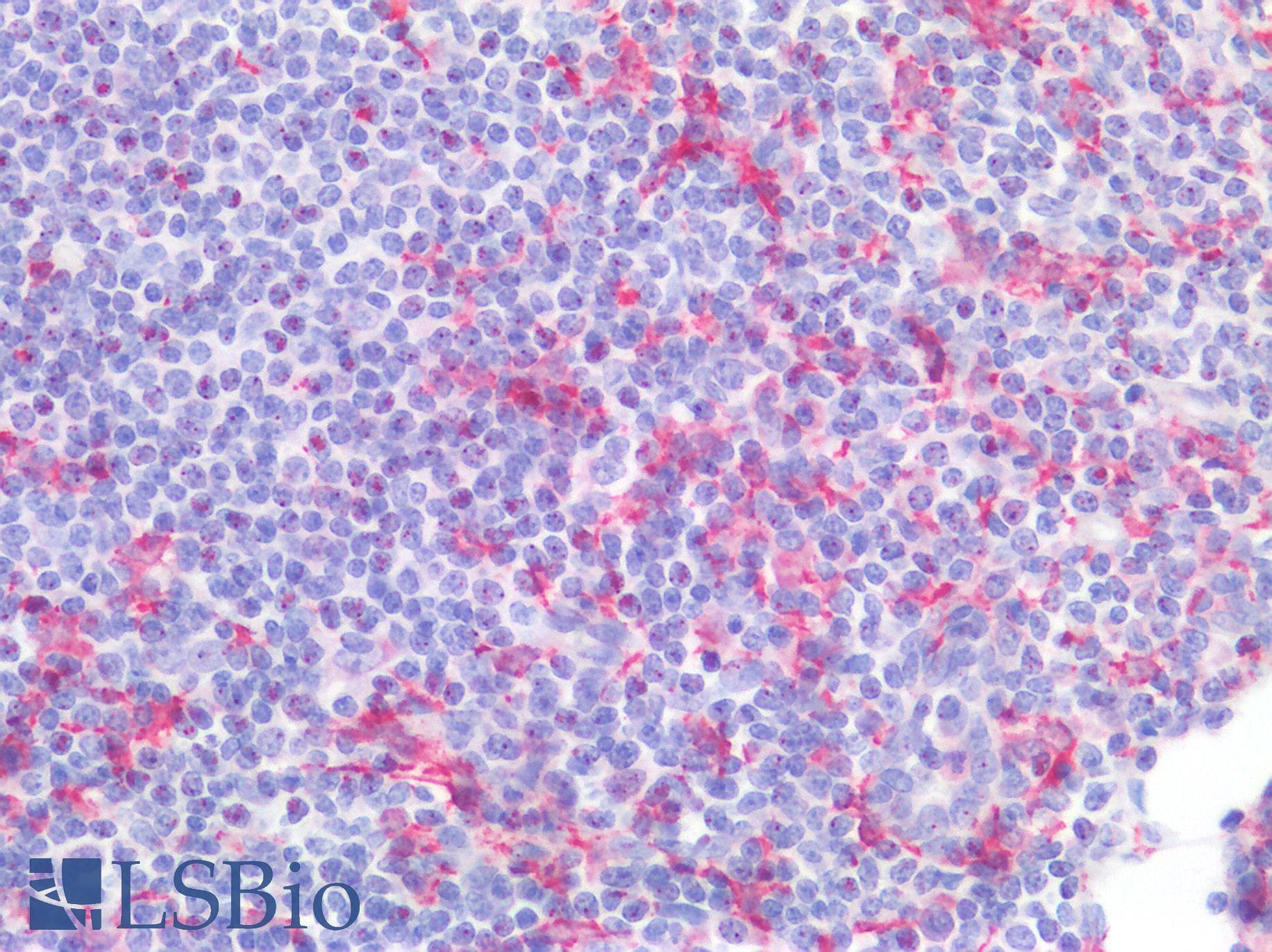 PathPlus™ AIF1 / IBA1 Antibody