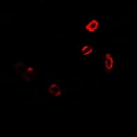 UGT1A9 Antibody
