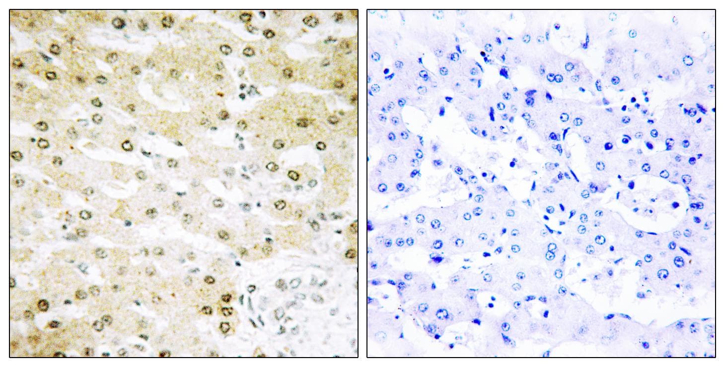 Polyclonal Rabbit anti-Human TOP2A / Topoisomerase II Alpha Antibody (IHC, IF, WB)