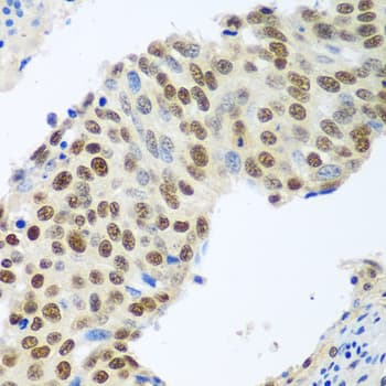 Polyclonal Rabbit anti-Human MDC1 Antibody (IHC, WB)