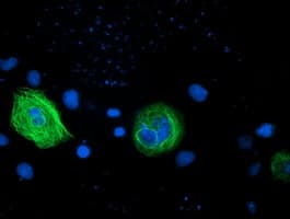 RASSF1 / RASSF1A Antibody (clone OTI9F5)