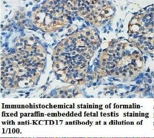 KCTD17 Antibody (aa67-230)