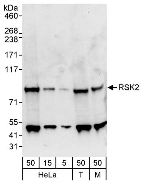 RPS6KA3 / RSK2 Antibody (aa1-50)