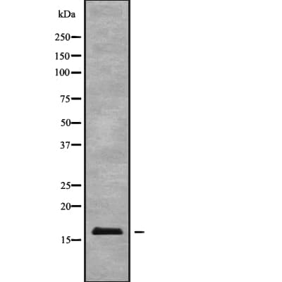Polyclonal Rabbit anti-Human BTF3L4 Antibody (WB)