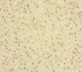 MMACHC Antibody