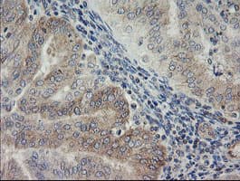 NNA1 / AGTPBP1 Antibody (clone OTI9A3)