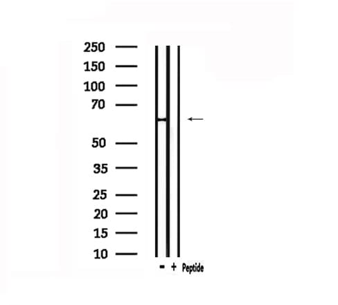 Polyclonal Rabbit anti-Human PTHR / PTHR1 Antibody (IHC, IF, WB)