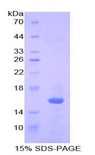 Mouse IL16 Protein (Recombinant His-T7)