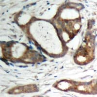 PKP2 / Plakophilin 2 Antibody (C-Terminus)