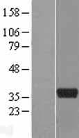 ART5 Protein (Over-Expression Lysate Myc-DDK (Flag))