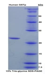 Human GSTP1 / GST Pi Protein (Recombinant His)