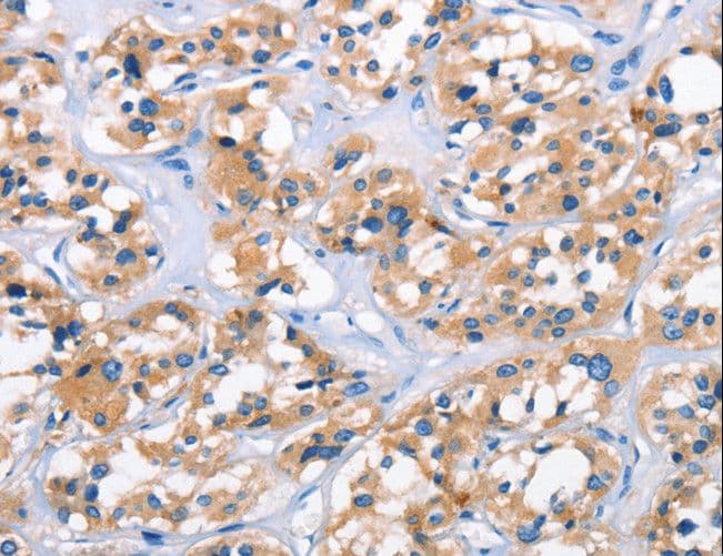 APOL6 / Apolipoprotein L 6 Antibody